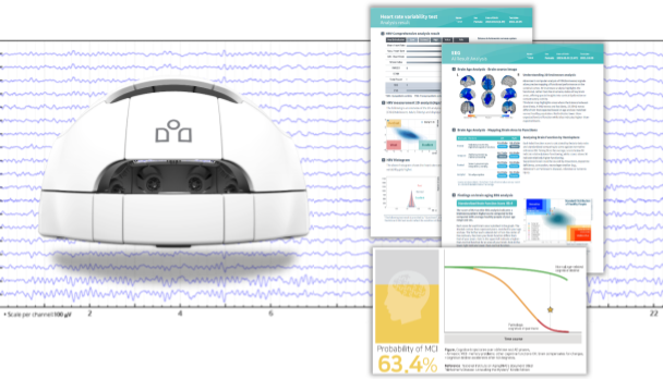 iSyncBrain AI Analysis