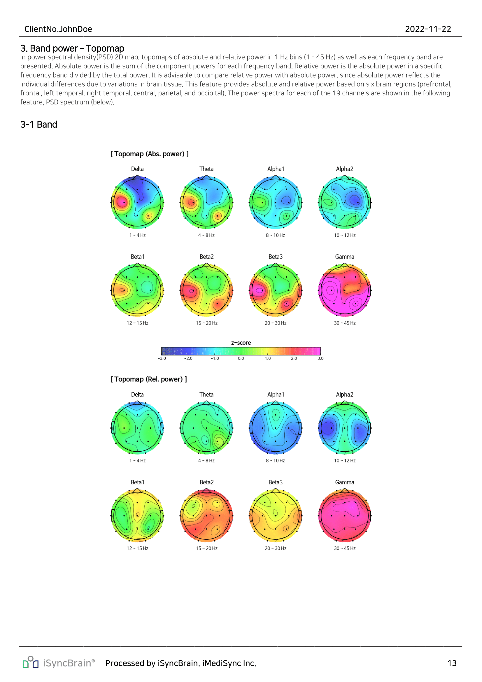 iSyncBrain normative qEEG report