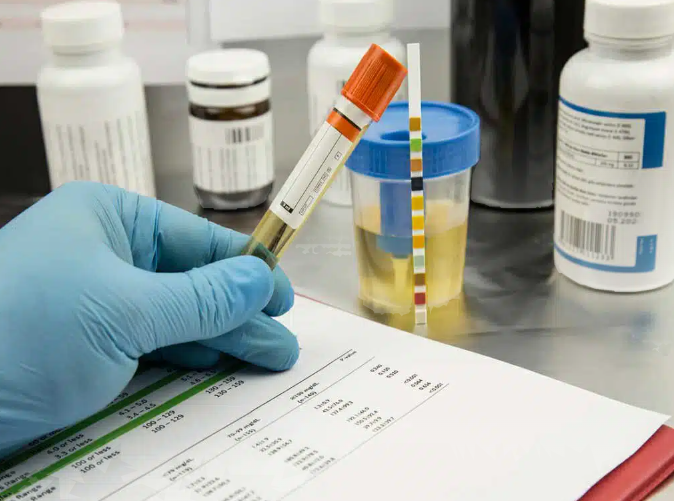 Drug and alcohol testing lab sample