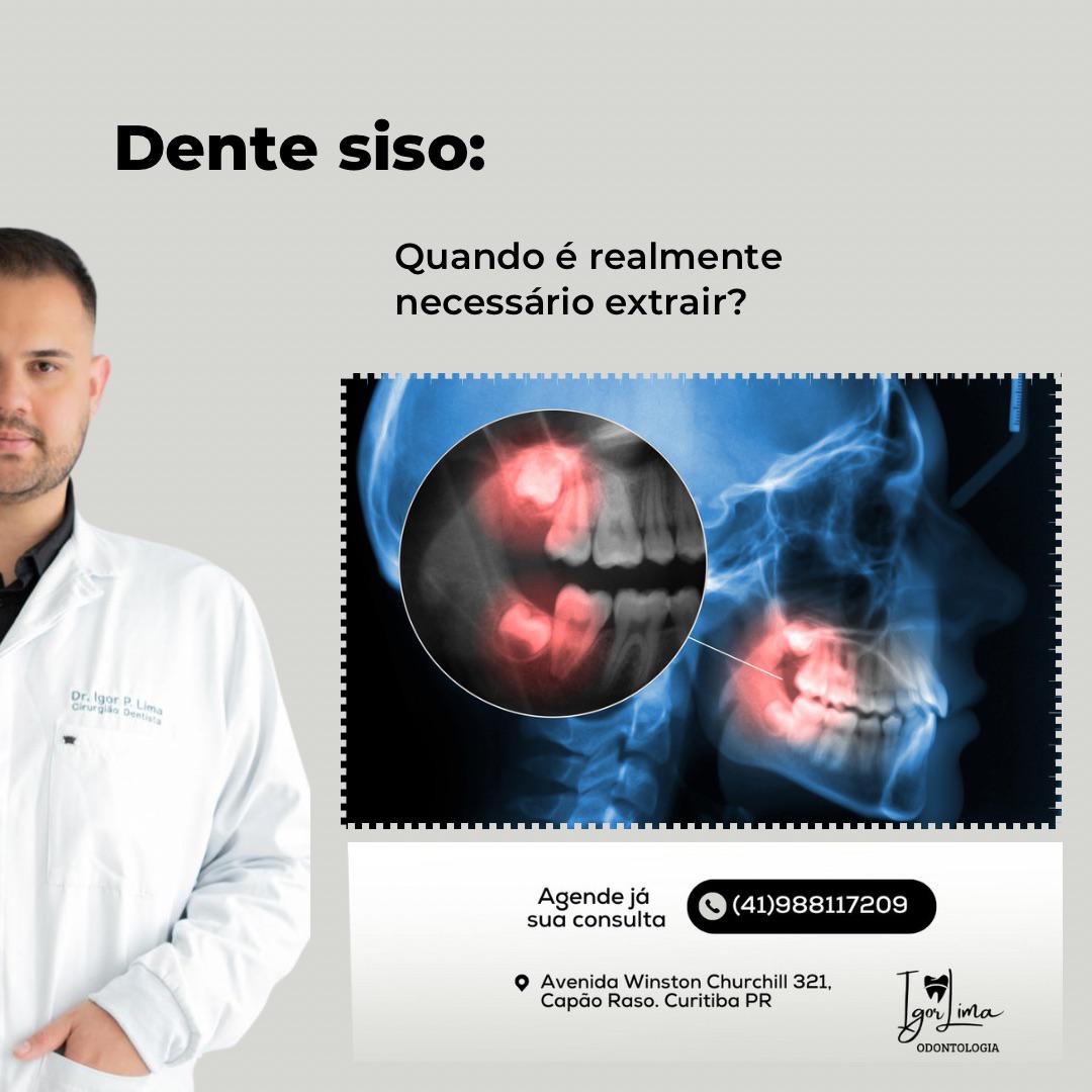 Banner informativo sobre dente siso